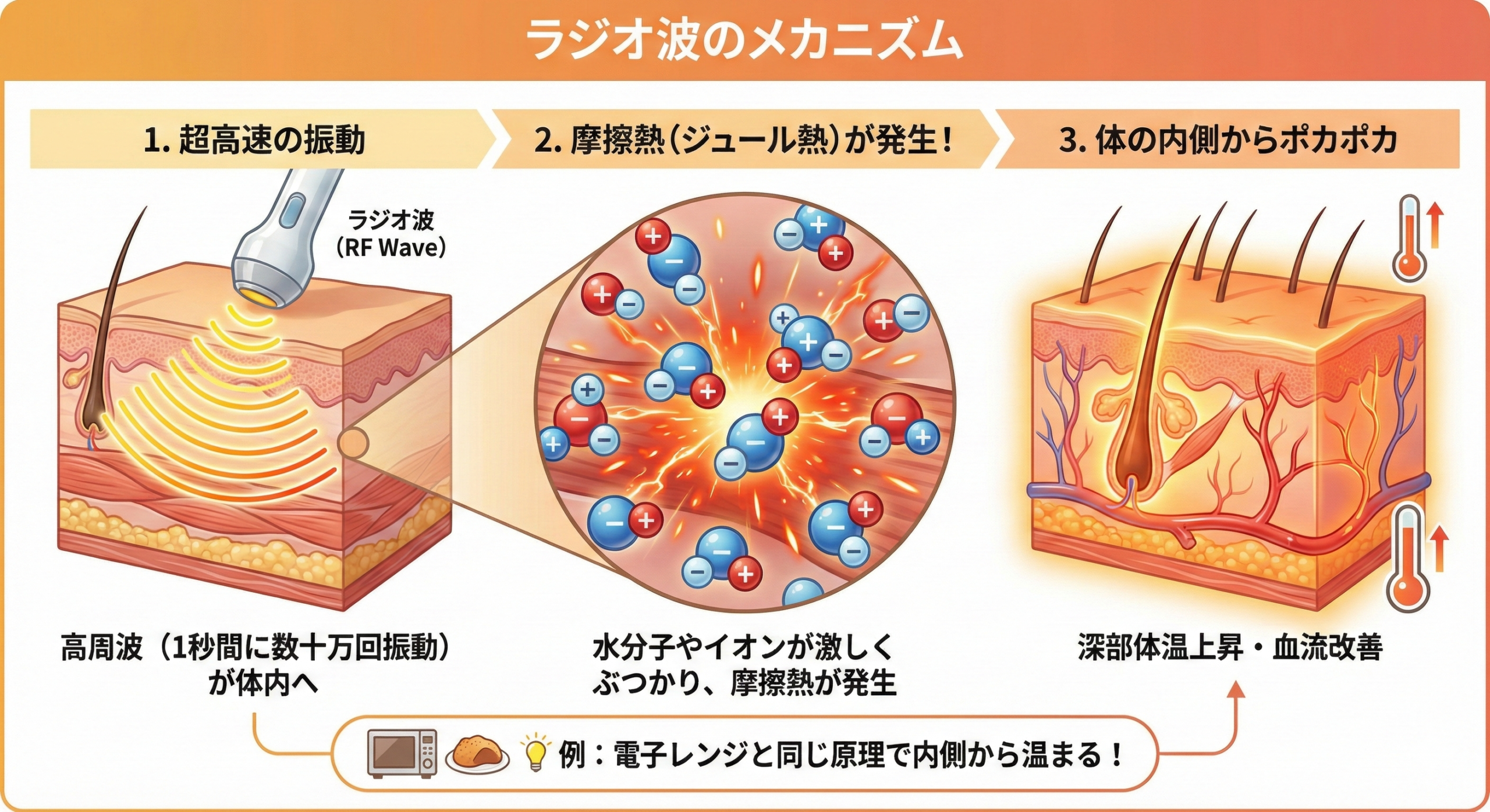 北九州市小倉北区だるま整骨院監修のサロンF（エフ）では最新医療機器のラジオスティムを使用した温熱施術を提供しています。ラジオ波は体内にジュール熱を発生し、体の中から体の中から温めることで体温の上昇、血流を根本から改善していきます。